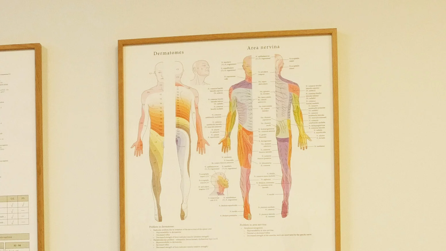CRPS erstatning
